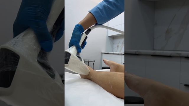 ПРОЦЕСС ПРОЦЕДУРЫ ЛАЗЕРНОЙ ЭПИЛЯЦИИ✅ #рекомендации #эпиляция #топ смотреть онлайн