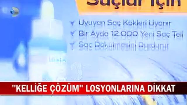 Saç Uzattığı İddia Edilen Losyonlardan Uzak Durun! смотреть онлайн