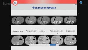 Петрушин А.В. "Опыт локального контроля"