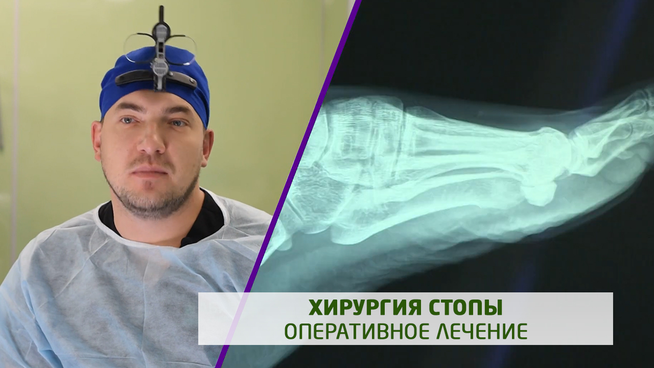 Врач ортопед-травматолог Гарипов Р. Р. о хирургии стопы в клинике 'АБИА'