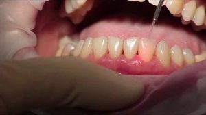 4 Пародонтология