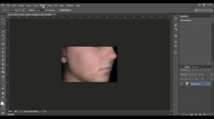 how to remove acne in photoshop cs 6