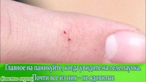 ➤ 8 видов укусов насекомых, о которые вы должны знать ➤ Как отличить ➤ Кто нас кусает? ➤