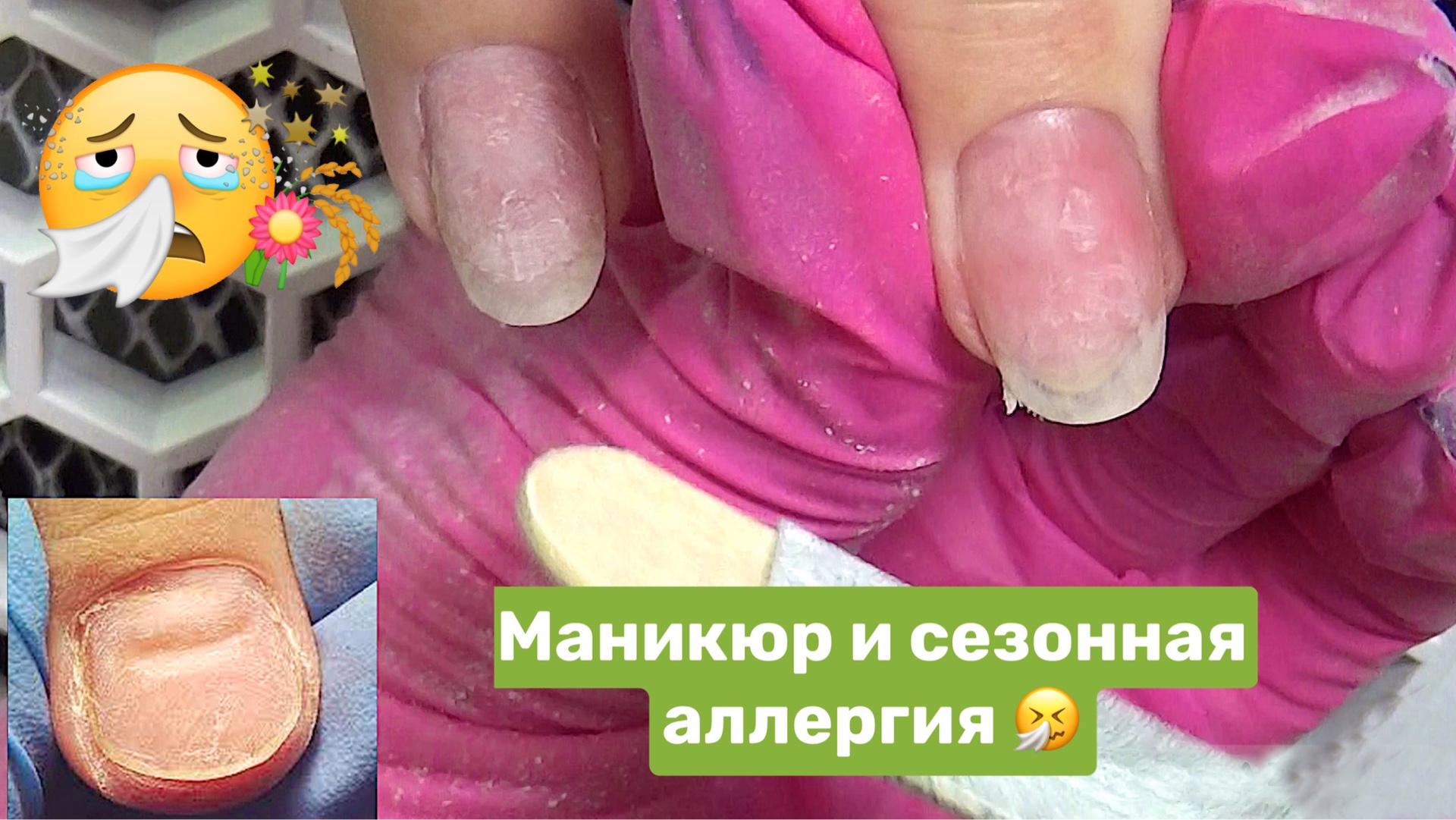 Комбинированный маникюр. Сезонная аллергия. Как работать? смотреть онлайн