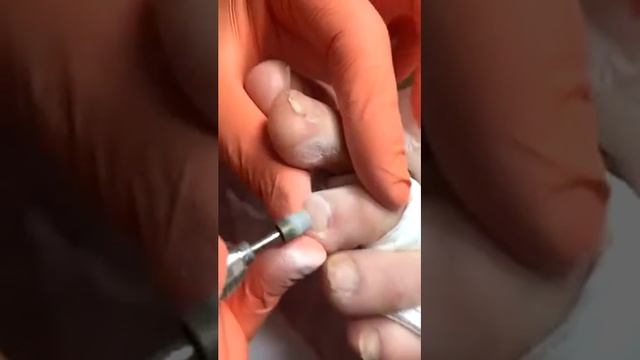 Семинар Baehr смотреть онлайн