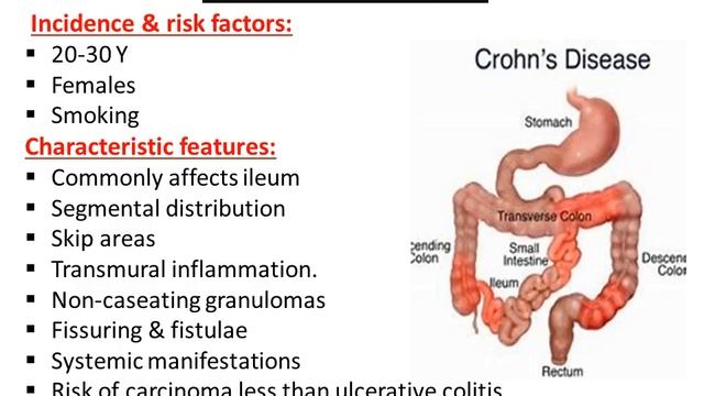 MED-LEVEL2-GIT-Diseases of intestines (2)-24/3/2021 смотреть онлайн