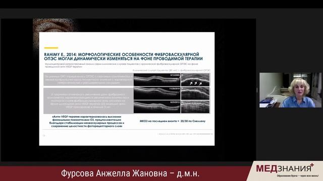 Ведение пациента с нВМД - ключевые принципы и тонкие нюансы смотреть онлайн