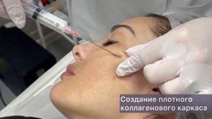 Инъекции полимолочной кислоты