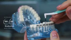 Зубные ершики — как ими пользоваться?