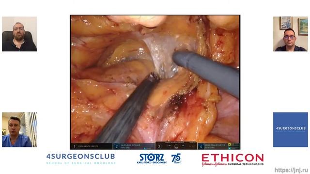 Робот или лапароскопия? Простатэктомия. Взгляд двух столиц. Орлов и Широкорад смотреть онлайн