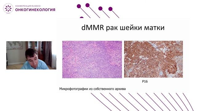 Определение MSI, PDL-1 статуса, методики выбора смотреть онлайн