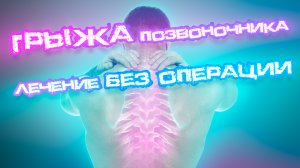 Грыжа позвоночника! Лечение без операции! #грыжа #медицина #здоровье #грыжапозвоночника #доктор