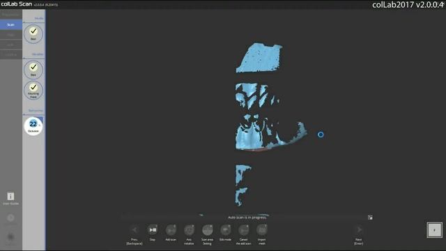 38 Aligning scan data in virtual articulators without a special jig