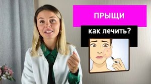 Прыщи: как лечить?