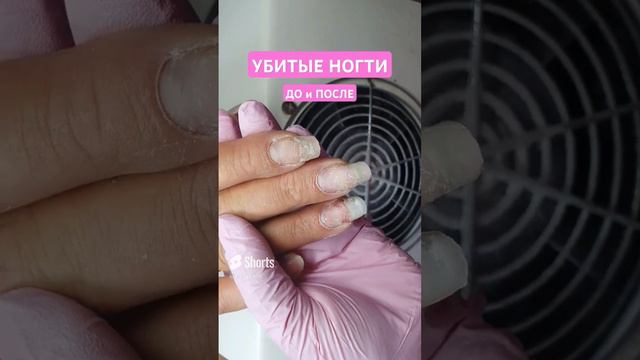 ИСПОРТИЛИ НОГТИ