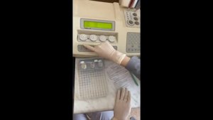 Выполнение коагулограммы четырёхканальным коагулометром Solar