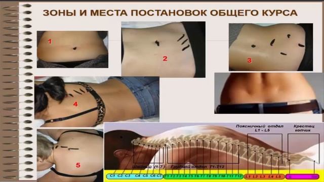 Гирудотерапия 4 лекция