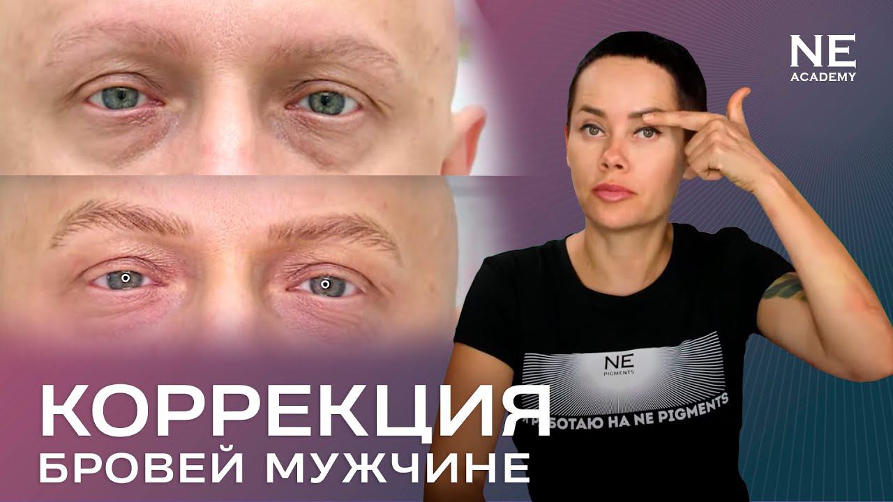 Коррекция бровей мужчине. #Татуаж при алопеции