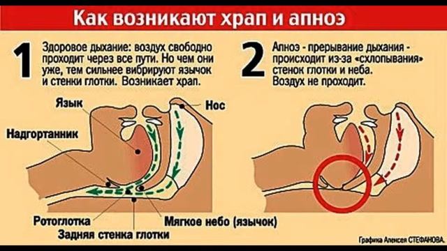 почему люди храпят смотреть онлайн