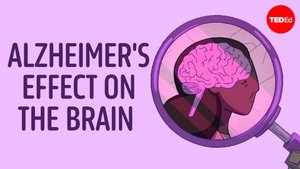 Почему болезнь Альцгеймера так сложно лечить?