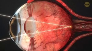 Что происходит внутри глаз
