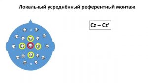 Методы монтажа на ЭЭГ