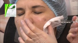 Объемное моделирование:скулы