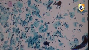 Актиномицеты. Цитологический практикум