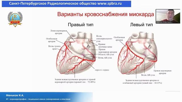 Меньков И.А.«КТ - коронарография – подводные камни сканирования и описания»