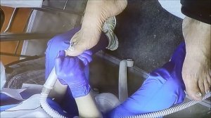 Обработка грибковых ногтей и стопы. Intersharm 2015. Подо-ликбез.