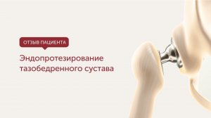 Эндопротезирование тазобедренного сустава. Отзыв пациента.