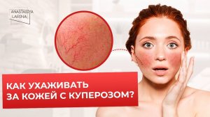 Как ухаживать за кожей с куперозом: советы косметолога | Анастасия Ларина | Школа косметологии