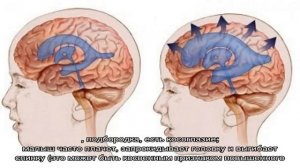 Что такое нейросонография у новорожденных и грудничков, как она проводится и что показывает?