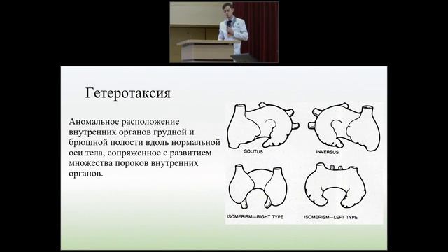 Редкий случай гетеротаксии в пульмонологической клинике  Междисциплинарный подход к диагностике