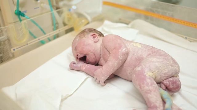 Кесарево сечение. Первые секунды жизни малыша. Республиканский клинический перинатальный центр смотреть онлайн