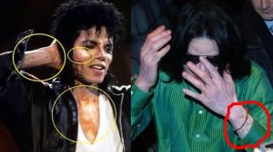 ПОЧЕМУ МАЙКЛ ДЖЕКСОН СТАЛ БЕЛЫМ!!!