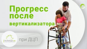 Аппараты на нижние конечности при ДЦП.