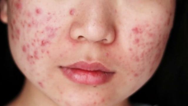 ХИМИЧЕСКИЕ И ФИЗИЧЕСКИЕ UVA / UVB ФИЛЬТРЫ В КОСМЕТИКЕ | Выбираем средство для защиты от солнца