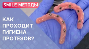 Гигиена зубных протезов на имплантах: результат до и после