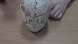 Свод черепа