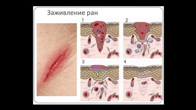 Коррекция в перманентном макияже смотреть онлайн