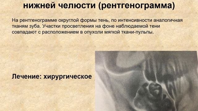 ОПУХОЛИ ЧАСТЬ 1 ДОБРОКАЧЕСТВЕННЫЕ НОВООБРАЗОВАНИЯ
