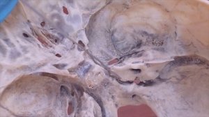 Височная и решетчатая кости. Каналы височной кости