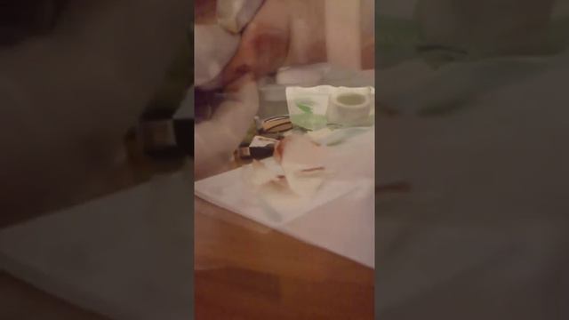 Без анестезии)))