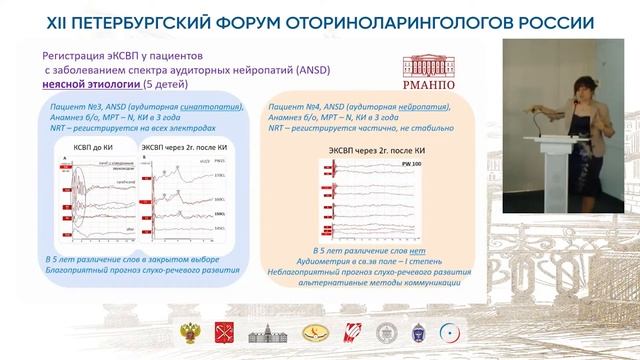 Кохлеарная имплантация