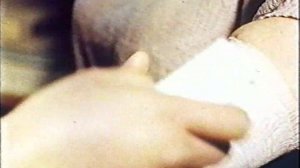 Первая помощь при ожогах