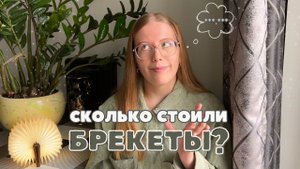 сколько стоят брекеты?  конкретные цифры / полтора года в брекетах