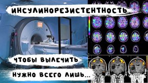 Как бесплатно вылечить инсулинорезистентность? Новые научные данные
