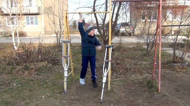 Vlog: Гуляю на костылях. У меня вся нога в гипсе!! смотреть онлайн