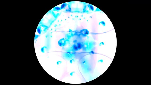 Matasism - Dub III [MA014] смотреть онлайн